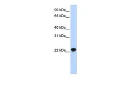 Anti-ARL8A antibody, Internal used in Western Blot (WB). GTX45736