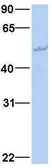 Anti-GLMN antibody, N-term used in Western Blot (WB). GTX45772