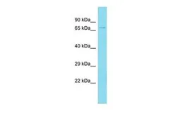 Anti-PADI2 antibody, Internal used in Western Blot (WB). GTX45793