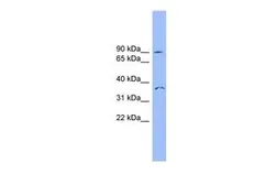 Anti-SDCCAG8 antibody, N-term used in Western Blot (WB). GTX45799