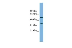 Anti-CFDP1 antibody, Internal used in Western Blot (WB). GTX45805