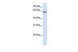 Anti-SLC47A2 antibody, C-term used in Western Blot (WB). GTX45823