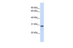 Anti-FAM78B antibody, Internal used in Western Blot (WB). GTX45837