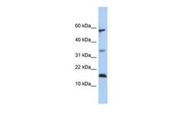 Anti-LCN6 antibody, Internal used in Western Blot (WB). GTX45870