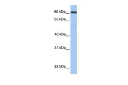 Anti-MMEL1 antibody, Internal used in Western Blot (WB). GTX45904