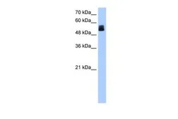 Anti-CRISPLD2 antibody, N-term used in Western Blot (WB). GTX45942