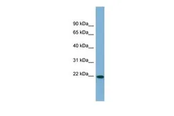 Anti-FNDC4 antibody, Internal used in Western Blot (WB). GTX46001