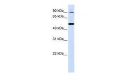 Anti-RHBDF1 antibody, N-term used in Western Blot (WB). GTX46013