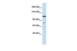 Anti-EIG121 antibody, N-term used in Western Blot (WB). GTX46044