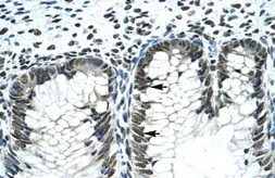 Anti-Gli2 antibody, Internal used in IHC (Paraffin sections) (IHC-P). GTX46056