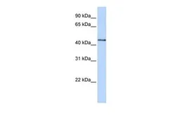 Anti-B3GNT4 antibody, N-term used in Western Blot (WB). GTX46158