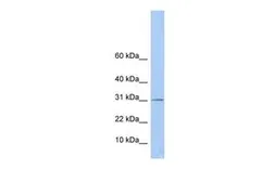 Anti-ECHDC1 antibody, Internal used in Western Blot (WB). GTX46182