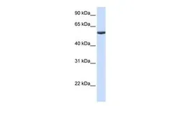 Anti-PHF10 antibody, Internal used in Western Blot (WB). GTX46183