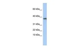Anti-GLYAT antibody, N-term used in Western Blot (WB). GTX46205