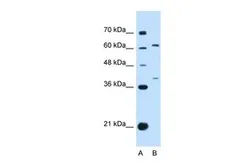 Anti-IL28 Receptor alpha antibody, N-term used in Western Blot (WB). GTX46260