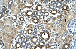 Anti-Matriptase / ST14 antibody used in IHC (Paraffin sections) (IHC-P). GTX46264