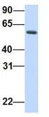 Anti-REC8 antibody, N-term used in Western Blot (WB). GTX46265
