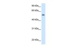 Anti-EXD antibody, C-term used in Western Blot (WB). GTX46279