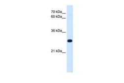 Anti-ANTP antibody, C-term used in Western Blot (WB). GTX46280