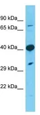 Anti-TMEM30A antibody, Internal used in Western Blot (WB). GTX46298