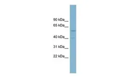 Anti-SUSD4 antibody, Internal used in Western Blot (WB). GTX46311