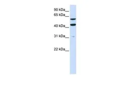 Anti-PTDSS1 antibody, N-term used in Western Blot (WB). GTX46366
