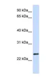 Anti-ERVWE1 antibody, N-term used in Western Blot (WB). GTX46373