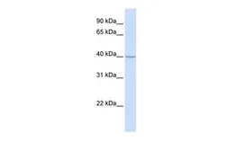 Anti-TRAM2 antibody, N-term used in Western Blot (WB). GTX46391