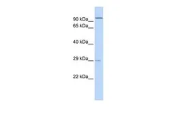 Anti-SSPN antibody, Internal used in Western Blot (WB). GTX46428