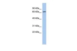 Anti-ERP72 antibody, N-term used in Western Blot (WB). GTX46431