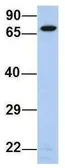 Anti-ERP72 antibody, Internal used in Western Blot (WB). GTX46432