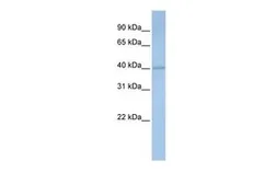 Anti-PDSS1 antibody, Internal used in Western Blot (WB). GTX46474
