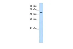 Anti-SHMT2 antibody, N-term used in Western Blot (WB). GTX46482