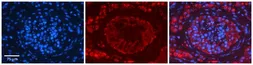 Anti-EPRS antibody, Internal used in IHC (Paraffin sections) (IHC-P). GTX46488