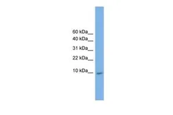 Anti-KRTAP23-1 antibody, Internal used in Western Blot (WB). GTX46504