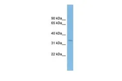 Anti-TRAP alpha antibody, Internal used in Western Blot (WB). GTX46555