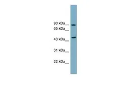 Anti-SMPD2 antibody, N-term used in Western Blot (WB). GTX46558