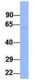 Anti-FMO4 antibody, N-term used in Western Blot (WB). GTX46568