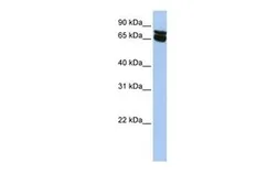 Anti-B4GALNT1 antibody, N-term used in Western Blot (WB). GTX46574