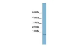 Anti-Motilin antibody, Internal used in Western Blot (WB). GTX46598