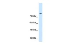 Anti-NRCAM antibody, N-term used in Western Blot (WB). GTX46618