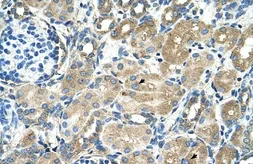 Anti-TM9SF1 antibody, Internal used in IHC (Paraffin sections) (IHC-P). GTX46657