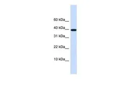 Anti-LECT1 antibody, N-term used in Western Blot (WB). GTX46674