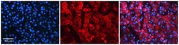 Anti-NIPA2 antibody, Internal used in IHC (Paraffin sections) (IHC-P). GTX46683
