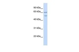 Anti-TTYH1 antibody, N-term used in Western Blot (WB). GTX46704