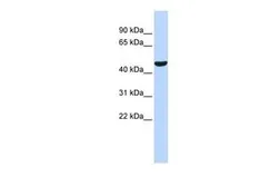 Anti-PTGIS antibody, Internal used in Western Blot (WB). GTX46738