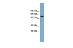 Anti-KCC2 antibody, Internal used in Western Blot (WB). GTX46802