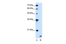 Anti-RNF175 antibody, Internal used in Western Blot (WB). GTX46880