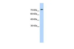 Anti-PANX2 antibody, N-term used in Western Blot (WB). GTX46957