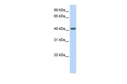 Anti-LRRC2 antibody, N-term used in Western Blot (WB). GTX46991